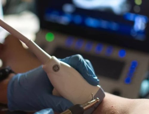 Neuromodulación Percutánea Ecoguiada